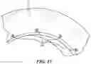 Fig. 16 - Drape for an imaging system gantry