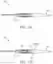 Fig. 10 - MOLDED TIP WITH EXTENDED GUIDEWIRE LUMEN AND ASSOCIATED DEVICES, SYSTEMS, AND METHODS