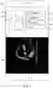 Fig. 07 - Methods and apparatuses for guiding collection of ultrasound data