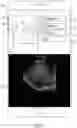 Fig. 08 - Methods and apparatuses for guiding collection of ultrasound data