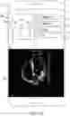 Fig. 13 - Methods and apparatuses for guiding collection of ultrasound data