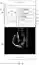 Fig. 14 - Methods and apparatuses for guiding collection of ultrasound data