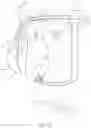 Fig. 04 - Closing device for an opening in the heart of a patient