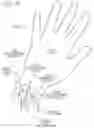 Fig. 100 - METHODS AND DEVICES TO DECREASE TISSUE TRAUMA DURING SURGERY