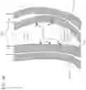 Fig. 113 - METHODS AND DEVICES TO DECREASE TISSUE TRAUMA DURING SURGERY