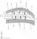 Fig. 115 - METHODS AND DEVICES TO DECREASE TISSUE TRAUMA DURING SURGERY