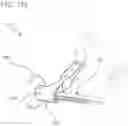 Fig. 137 - METHODS AND DEVICES TO DECREASE TISSUE TRAUMA DURING SURGERY