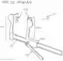 Fig. 32 - METHODS AND DEVICES TO DECREASE TISSUE TRAUMA DURING SURGERY