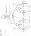 Fig. 74 - METHODS AND DEVICES TO DECREASE TISSUE TRAUMA DURING SURGERY