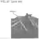 Fig. 80 - METHODS AND DEVICES TO DECREASE TISSUE TRAUMA DURING SURGERY