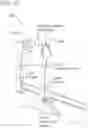 Fig. 93 - METHODS AND DEVICES TO DECREASE TISSUE TRAUMA DURING SURGERY
