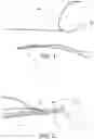 Fig. 02 - Methods of making reinforced soft tissue grafts with suture loop/needle constructs