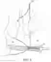 Fig. 03 - Methods of making reinforced soft tissue grafts with suture loop/needle constructs