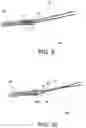 Fig. 07 - Methods of making reinforced soft tissue grafts with suture loop/needle constructs