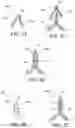 Fig. 13 - Methods of making reinforced soft tissue grafts with suture loop/needle constructs