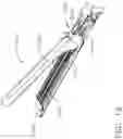 Fig. 12 - Surgical stapler anvils with tissue stop features configured to avoid tissue pinch