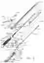 Fig. 06 - Reinforced deformable anvil tip for surgical stapler anvil