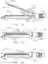Fig. 10 - Reinforced deformable anvil tip for surgical stapler anvil