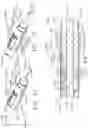 Fig. 37 - Powered articulatable surgical instruments with clutching and locking arrangements for linking an articulation drive system to a firing drive system
