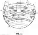 Fig. 08 - Surgical stapling device for performing circular anastomosis and surgical staples for use therewith