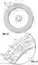 Fig. 09 - Surgical stapling device for performing circular anastomosis and surgical staples for use therewith