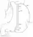 Fig. 01 - Polymer overmolded bariatric clamp and method of installing