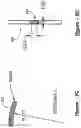Fig. 17 - Polymer overmolded bariatric clamp and method of installing