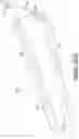 Fig. 48 - Polymer overmolded bariatric clamp and method of installing