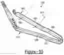 Fig. 69 - Polymer overmolded bariatric clamp and method of installing