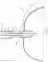 Fig. 11 - INFLATABLE ANCHORING STRUCTURE FOR IMPLANT AND DELIVERY SYSTEM
