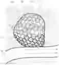Fig. 01 - Intrasaccular aneurysm occlusion device with net or mesh expanded by string-of-pearls embolies