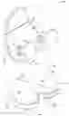 Fig. 01 - COMPOSITE JOINT ARTHROPLASTY SYSTEMS AND METHODS