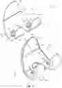 Fig. 03 - COMPOSITE JOINT ARTHROPLASTY SYSTEMS AND METHODS