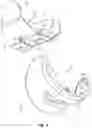 Fig. 04 - COMPOSITE JOINT ARTHROPLASTY SYSTEMS AND METHODS