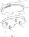 Fig. 06 - COMPOSITE JOINT ARTHROPLASTY SYSTEMS AND METHODS