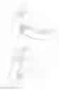 Fig. 11 - FOLDABLE, STOWABLE INTRAOSSEOUS DEVICE WITH AUTOMATIC POWER GENERATION WHEN OPENED