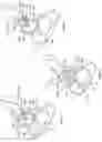 Fig. 02 - PATIENT-SPECIFIC ACETABULAR GUIDES AND ASSOCIATED INSTRUMENTS