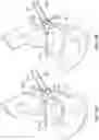 Fig. 22 - PATIENT-SPECIFIC ACETABULAR GUIDES AND ASSOCIATED INSTRUMENTS