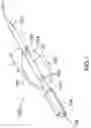 Fig. 05 - Device for delivering mechanical waves through a balloon catheter