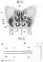 Fig. 30 - MAXILLARY SINUS PUNCTURE APPARATUS