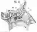 Fig. 31 - MAXILLARY SINUS PUNCTURE APPARATUS