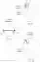 Fig. 04 - Causing ischemia in tumors