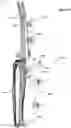 Fig. 22 - Anatomic external fixation system for the ankle