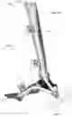 Fig. 49 - Anatomic external fixation system for the ankle