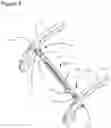 Fig. 05 - Orthopedic strut with multiple attachment clamps