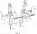 Fig. 16 - Surgical system