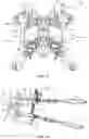 Fig. 19 - Surgical system