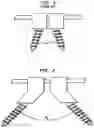 Fig. 02 - Stabilizing Bone Using Spinal Fixation Devices and Systems