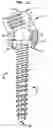 Fig. 07 - Stabilizing Bone Using Spinal Fixation Devices and Systems