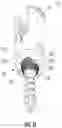 Fig. 06 - Polyaxial bone screw with increased angulation